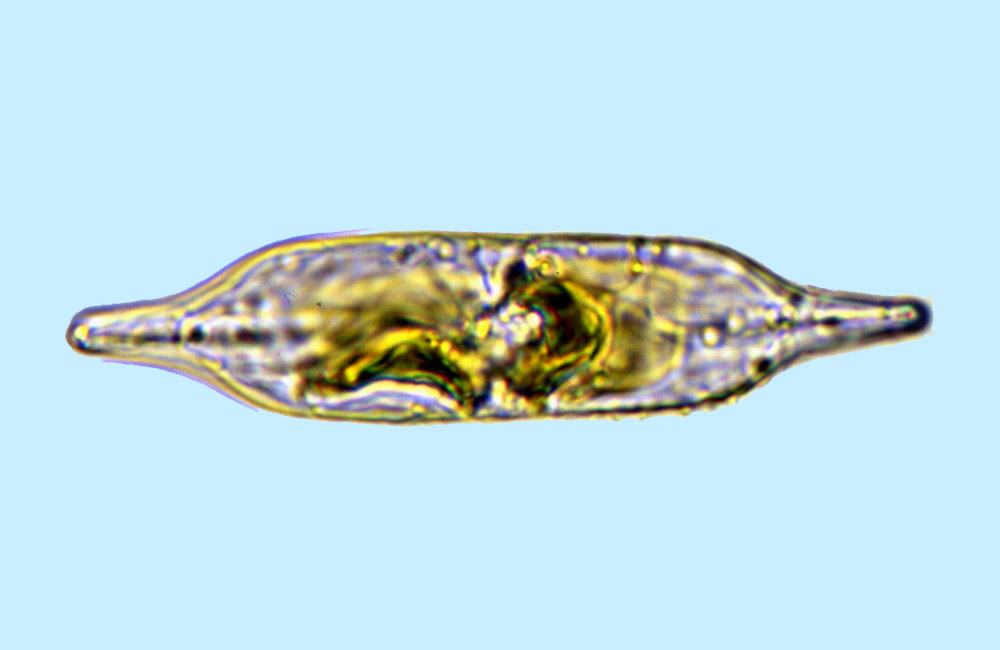 Nitzschiaunvivant
