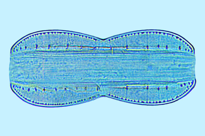 Nitzschia epithemioides