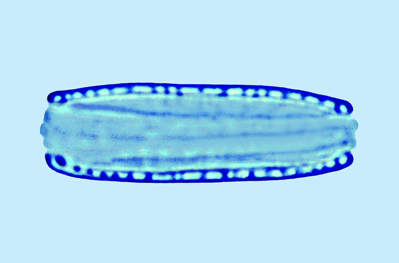 Mediolittoral Nitzschia hantzschiana