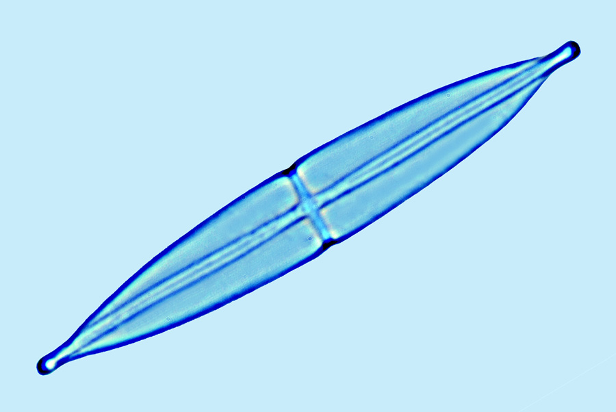 Mediolittoral Stauroneis anceps