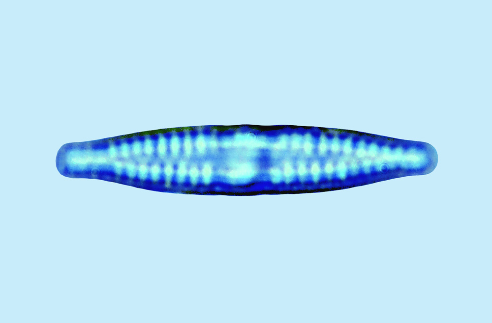 Mediolittoral Synedra vaucheriae