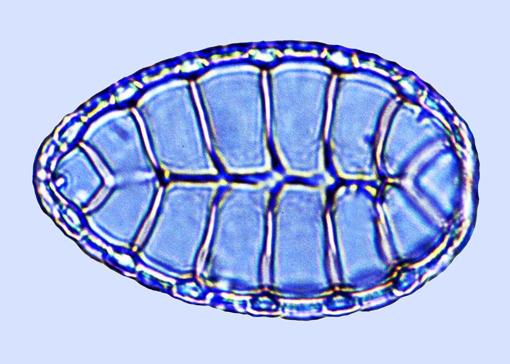 Surirella sp.