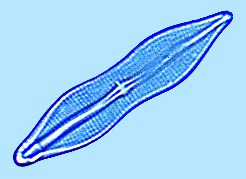 Mastomagal Mastogloia constricta