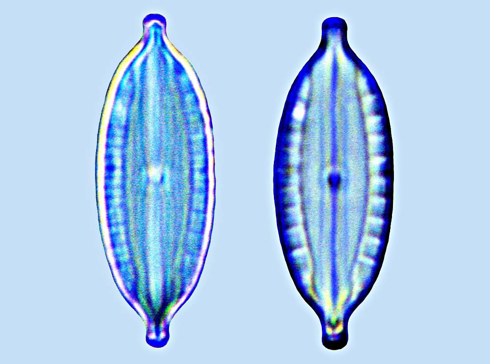 Mastomagal Mastogloia ignorata