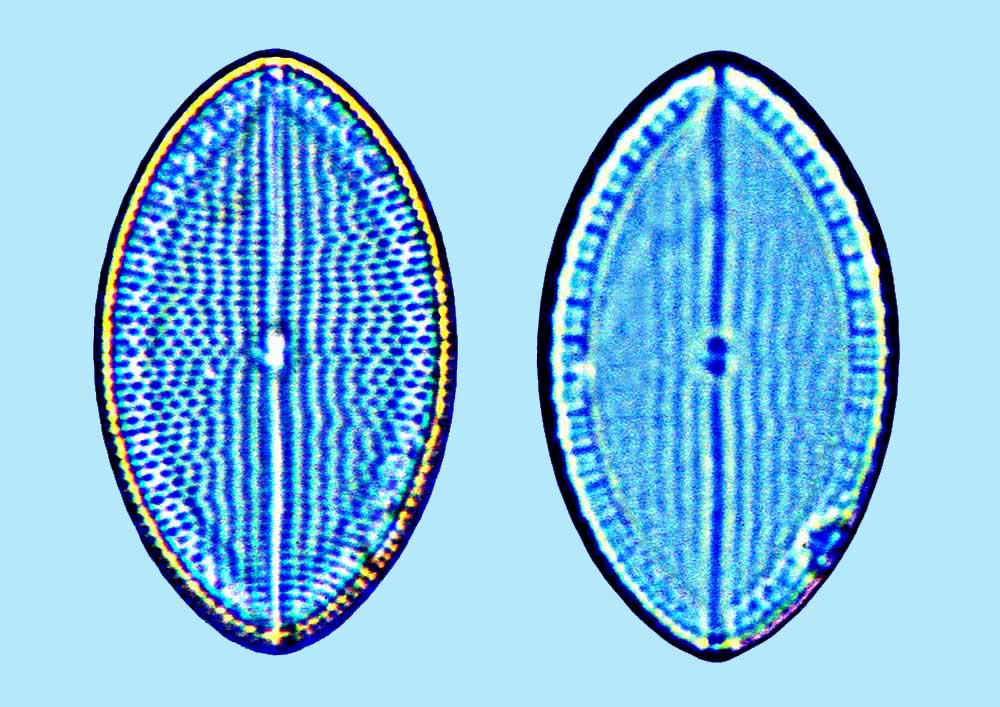 Mastomagal Mastogloia ovata