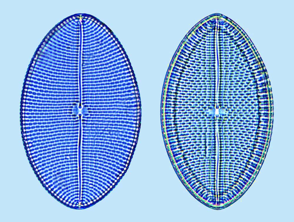 Mastomagal Mastogloia ovum paschale
