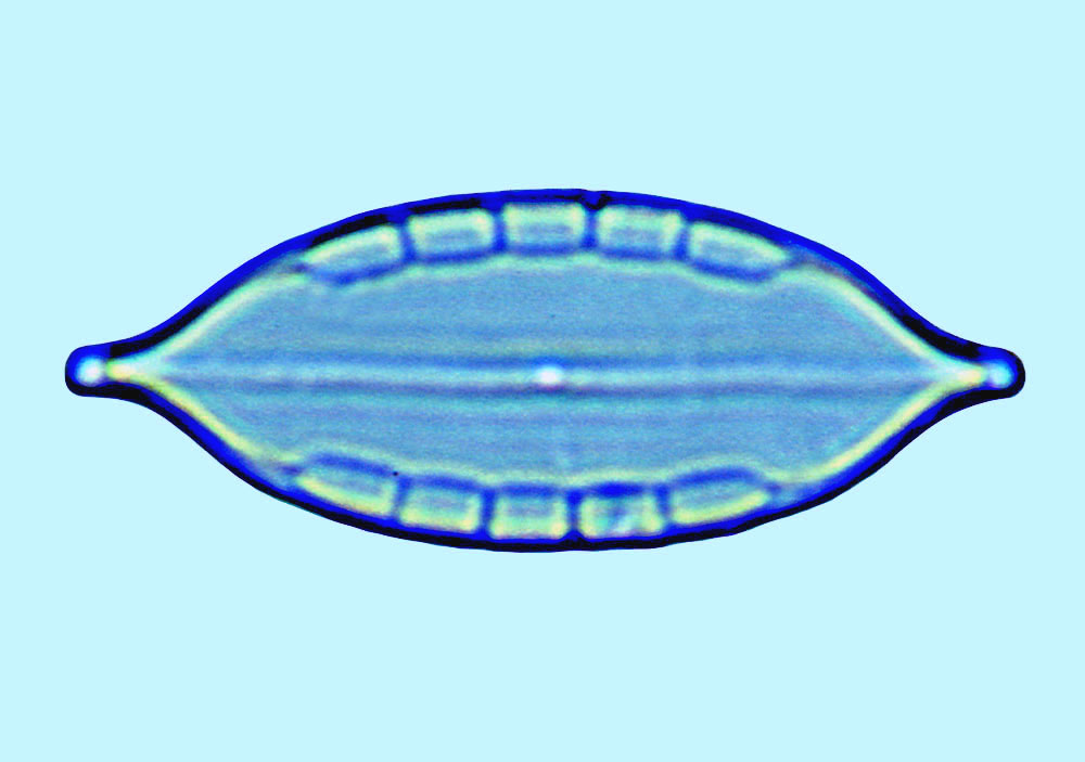 Mastomagal Mastogloia pisciculus