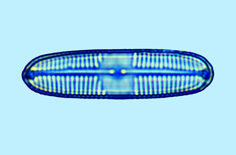 Pinnularia quadratarea