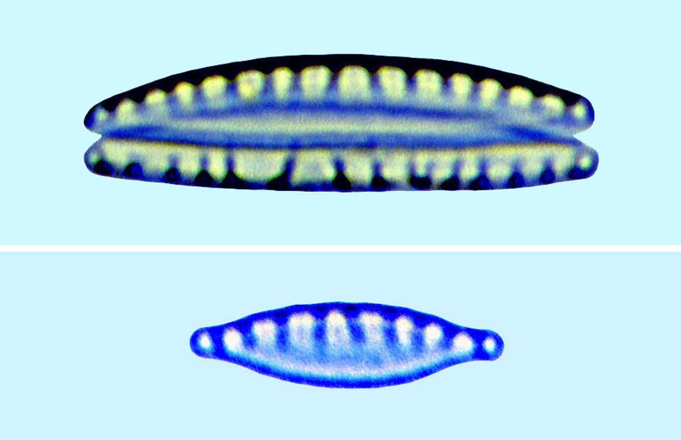 Nitzschia sp