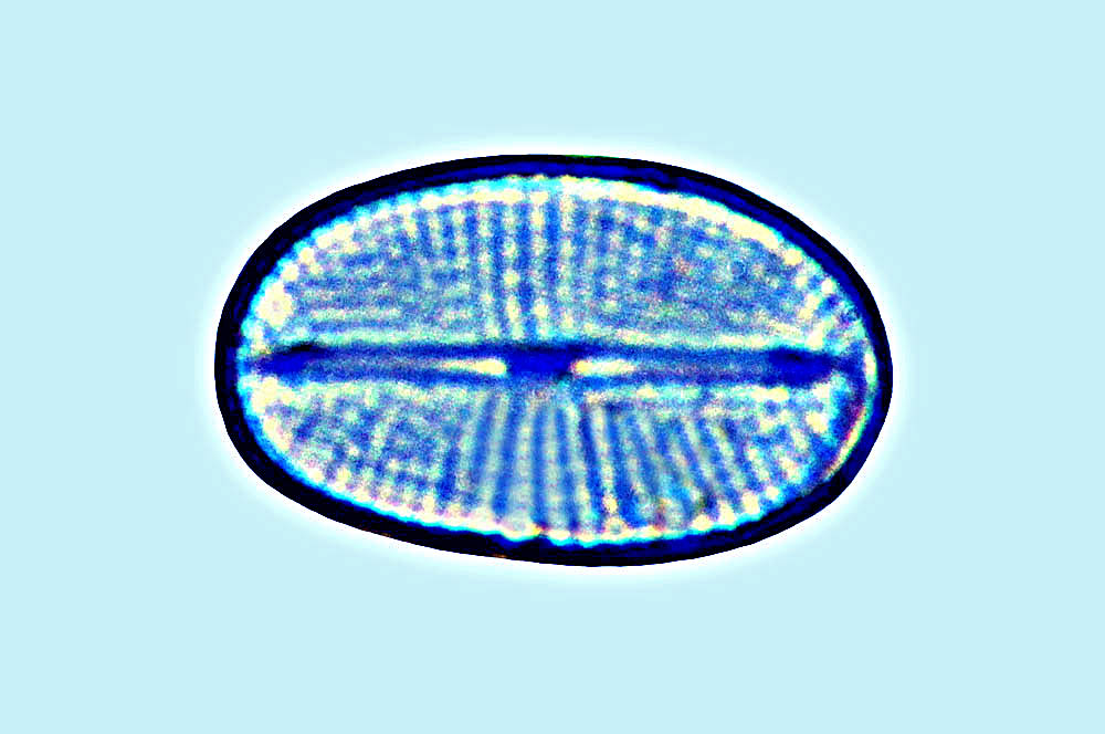 Cocconeiopsis pseudoorthoneoides