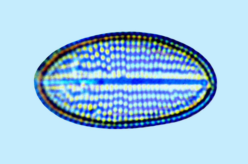 Cocconeis dirupta var. dirupta