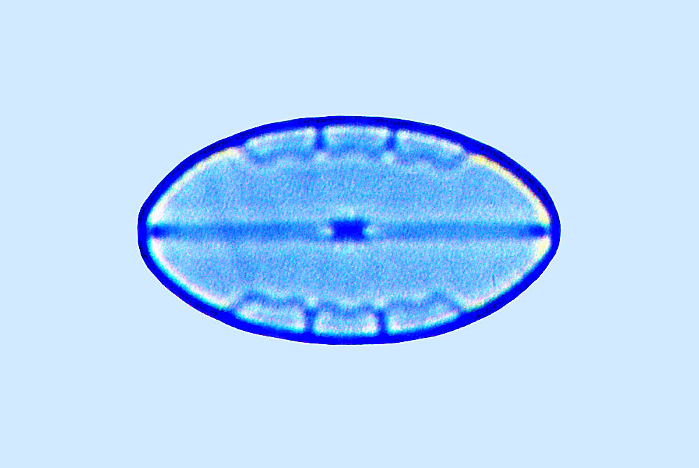 Mastogloia ovalis