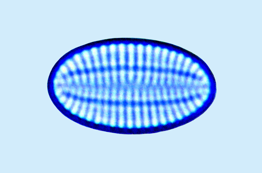Cocconeis peltoides