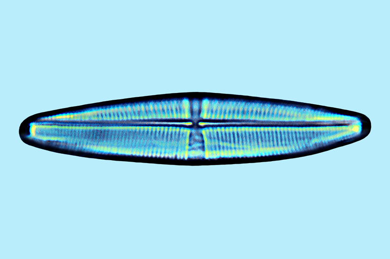 Saumatdeux Stauroneis dubitabilis