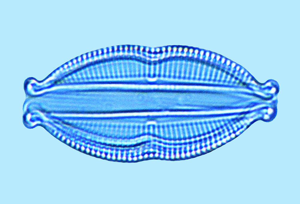 Amphora angularis