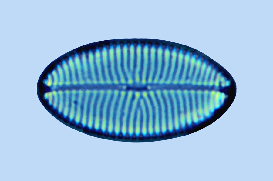 Diamagal navicula lusoria