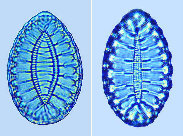 Surirellal fastuosa