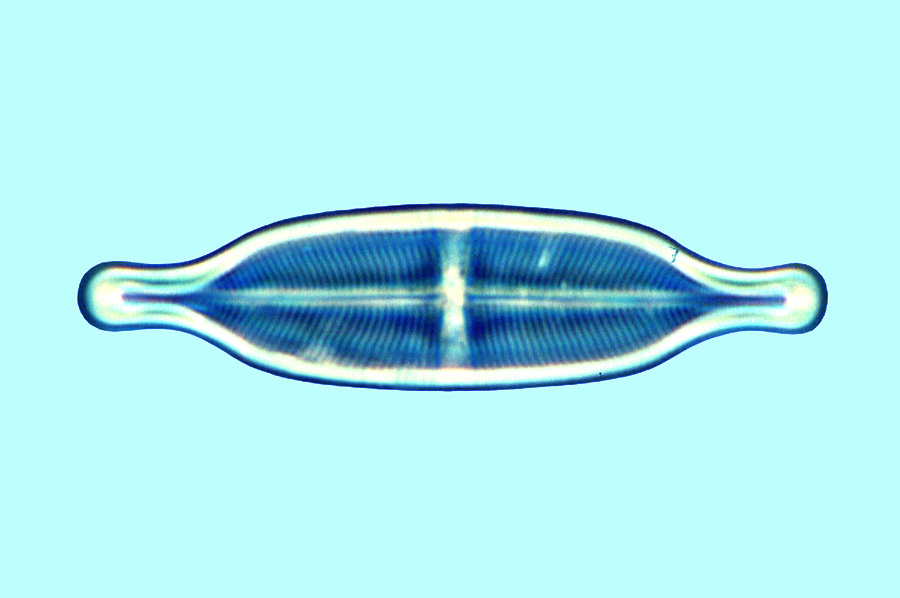 Mediolittoral Stauroneis anceps