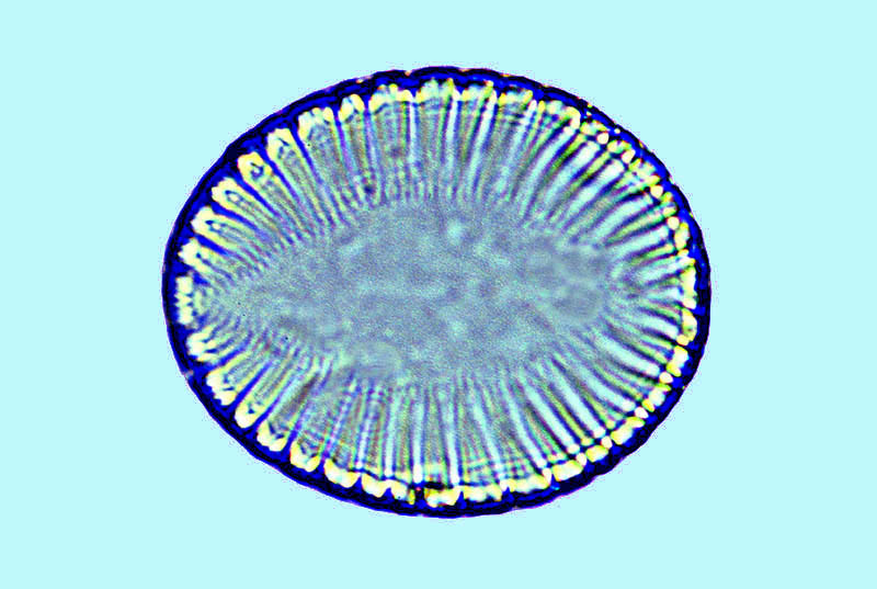 Mediolittoral Surirella ovata