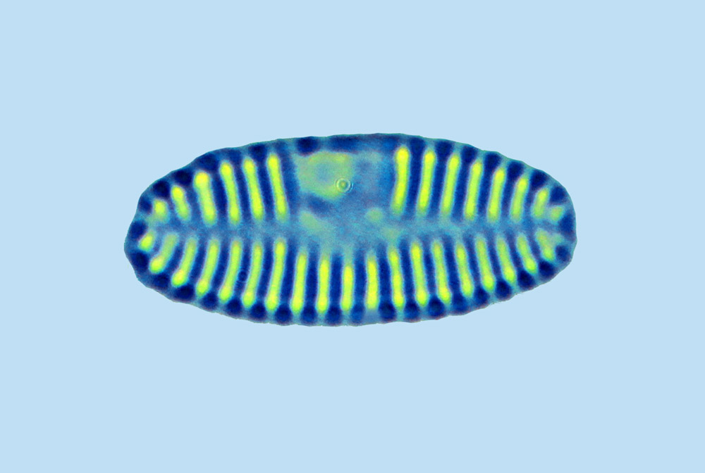 Mediolittoral Synedra ulna