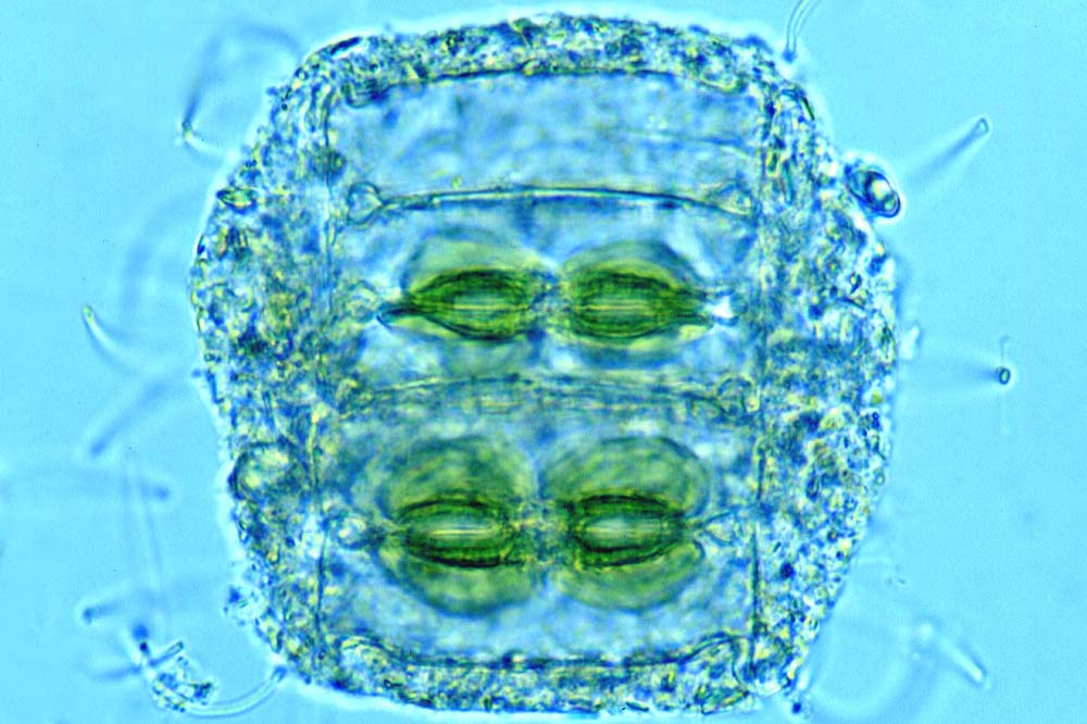 Plancton Actinocyclus octonarius