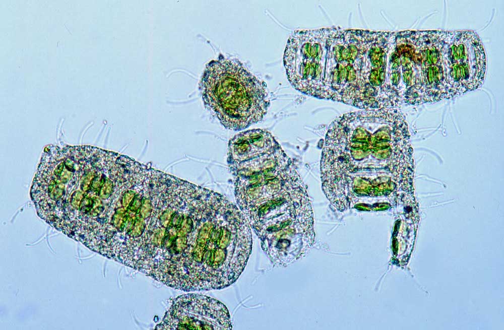 Plancton Actinocyclus octonarius