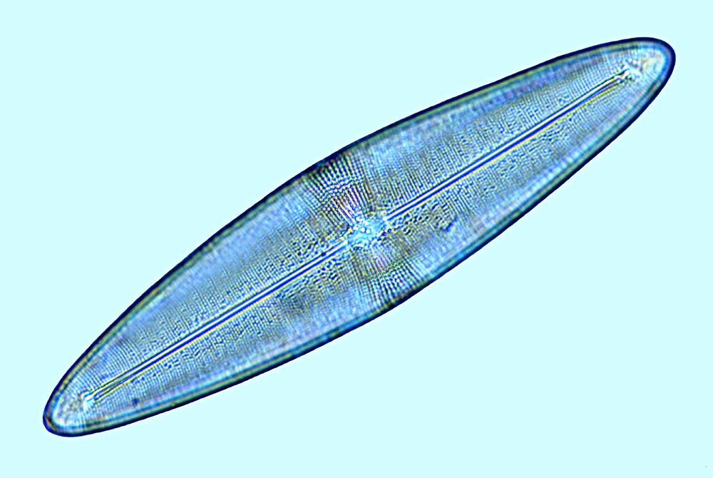 Parlibellus sp cf delognei