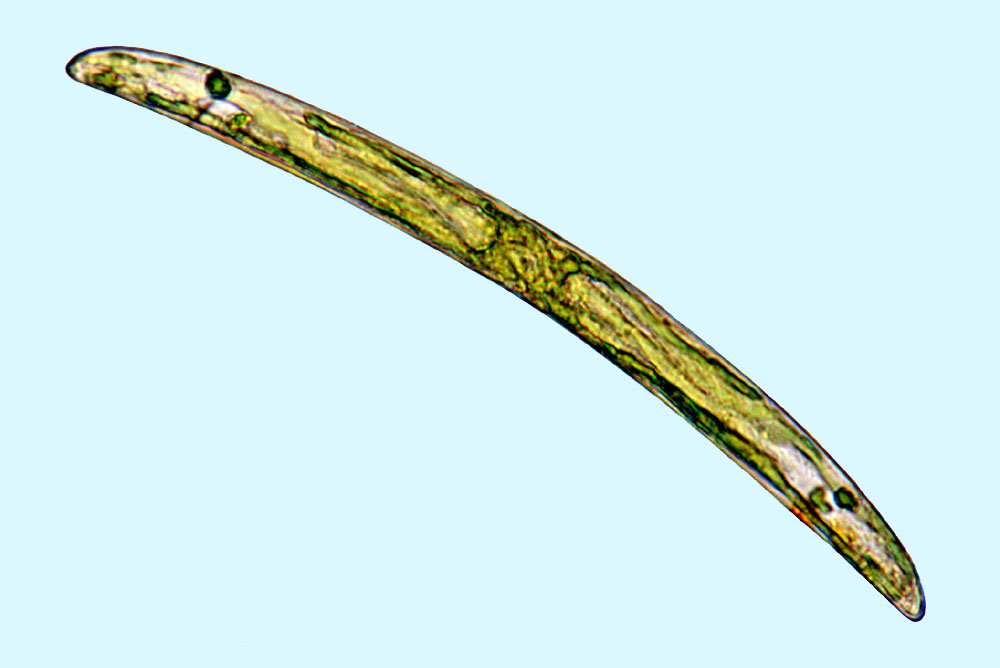 Raphoneis Rhoicosigma falcatum