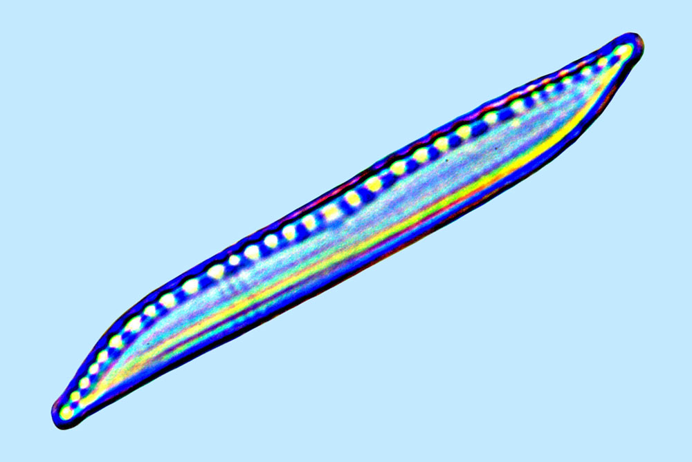 Nitzschia aremonica