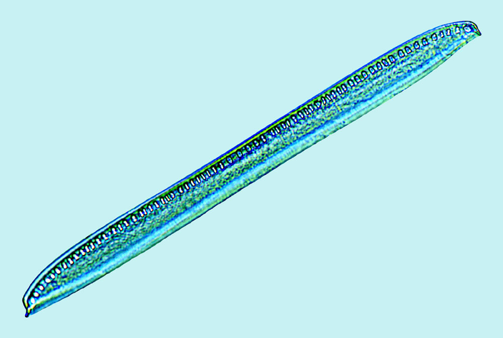 Saumatdeux Nitzschia vitrea