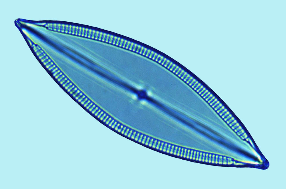 Nonident mastogloia decussata