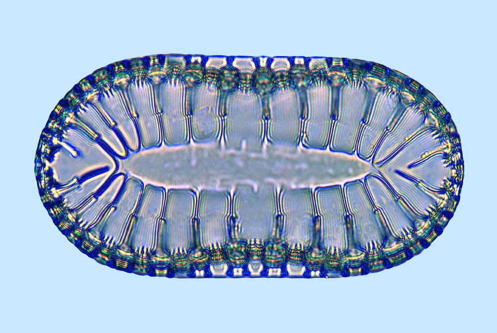 Raphoneis Surirella hybrida