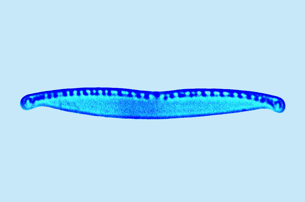 Saumatdeux Nitzschia dissipatoides