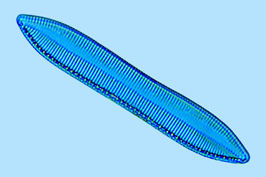 Nitzschia hungarica