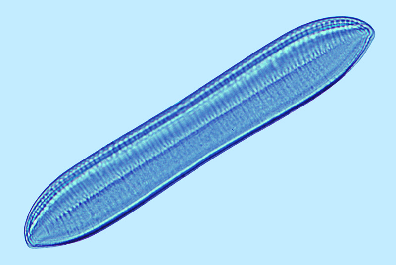 Saumatdeux Nitzschia littoralis