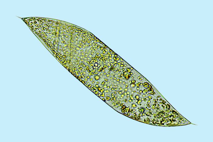 Plancton Rhizosolenia robusta