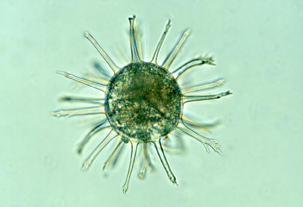 Kyste de Dinoflagellé