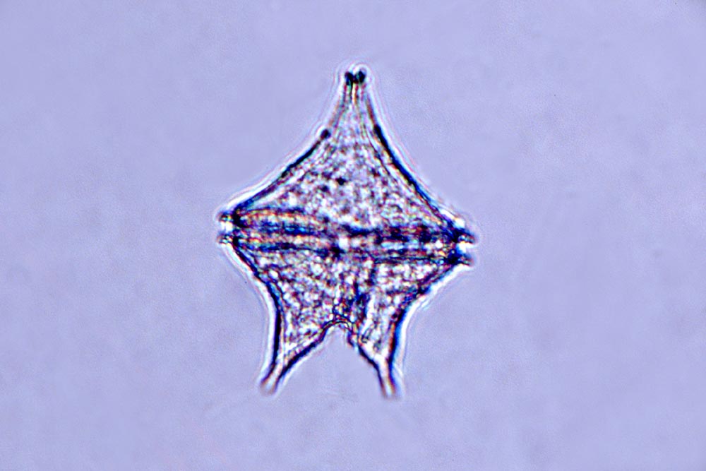 Protoperidinium divergens