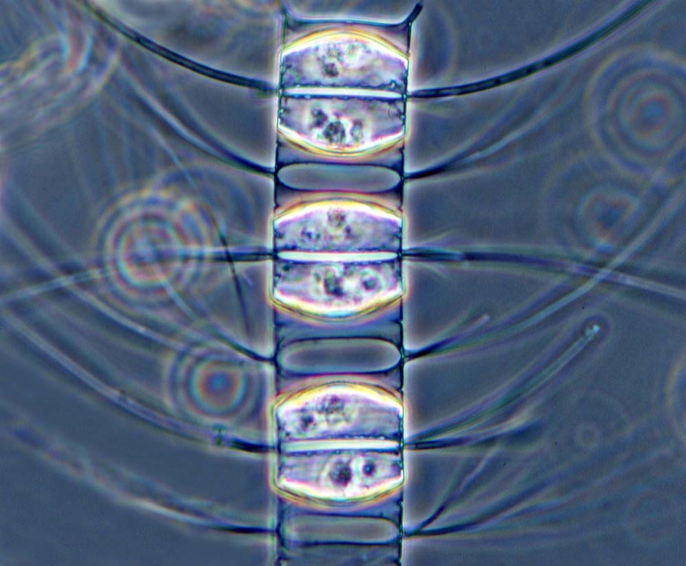 Plancton Chaetoceros constrictus