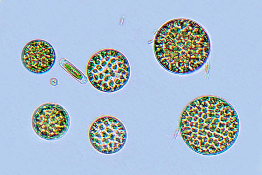 Plancton Actinocyclus octonarius