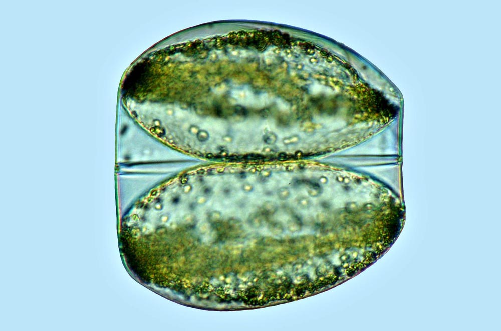 Plancton Coscinodiscus granii