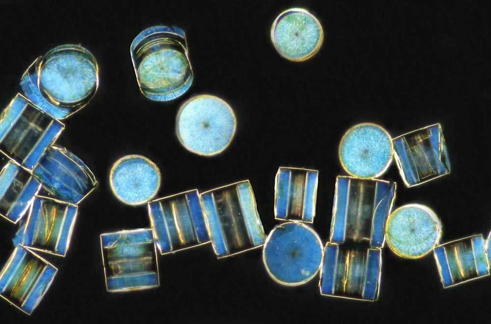 Plancton Coscinodiscus wailesii