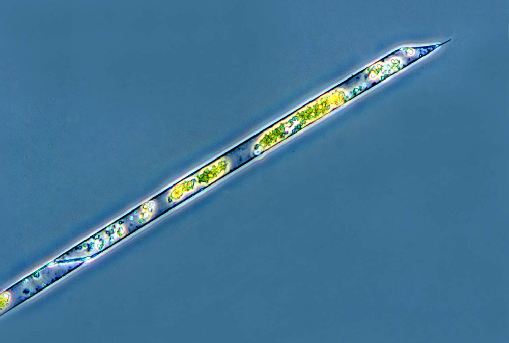 Plancton Rhizosolenia imbricata