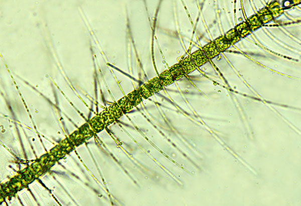 Chaetoceros eibenii