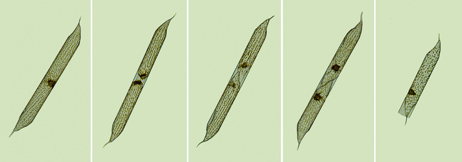 Plancton Rhizosolenia hyalina