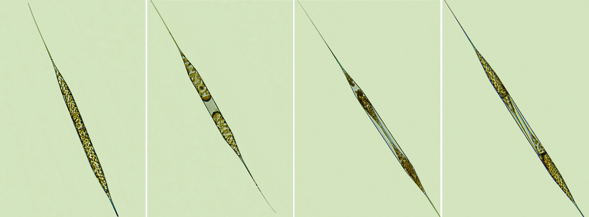 Plancton Rhizosolenia setigera